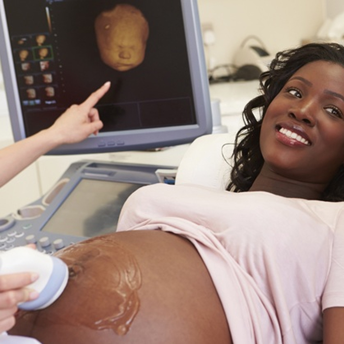 4D ULTRASOUND
