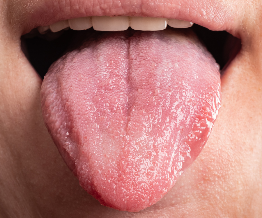 Clean Tongue
