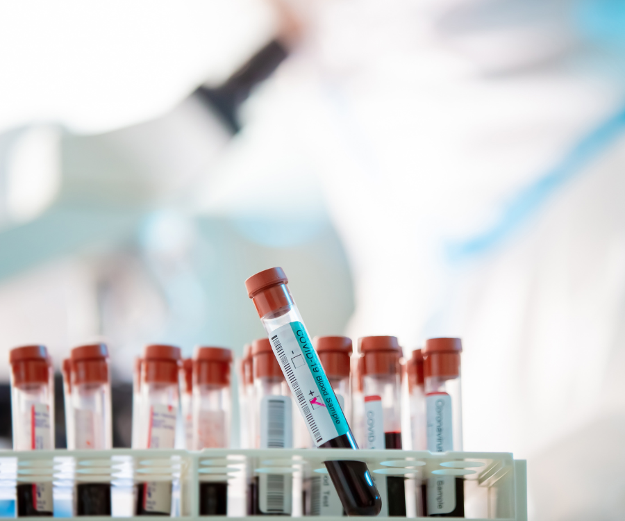 Over-Testing vs Under-Testing